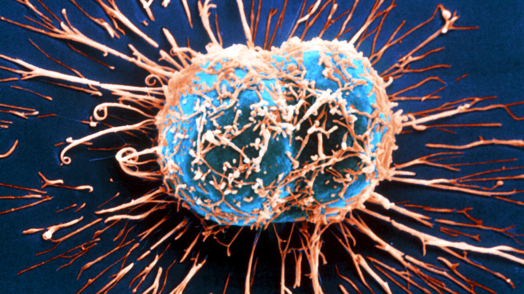 Cancer Cell