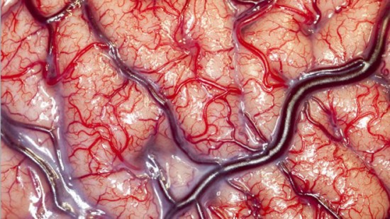 Brain