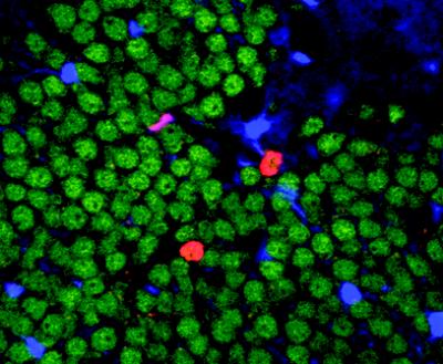 Neurogenesis