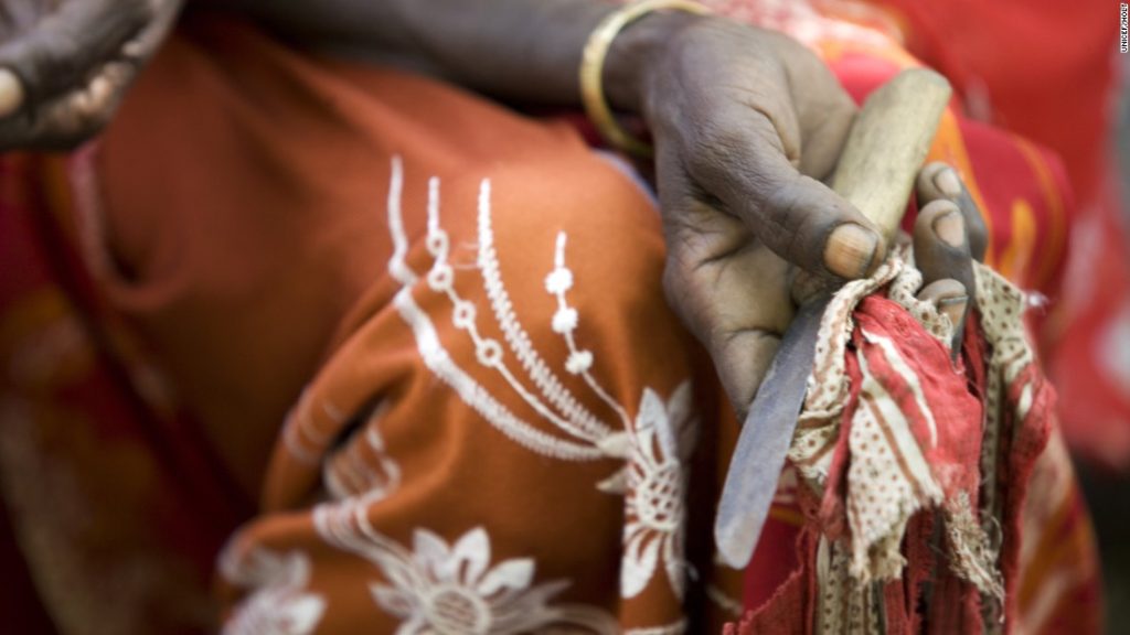 FGM