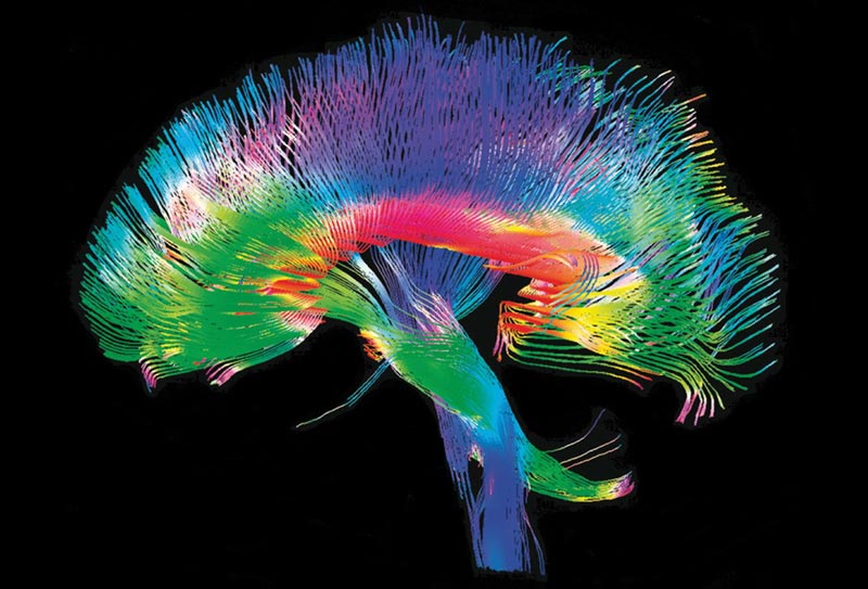 Rewiring the brain to stick to Ramadan resolutions