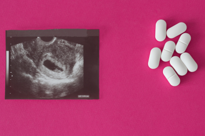 Is Abortion Allowed in Case of Rape?