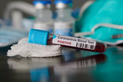 What Are the Islamic Guidelines on Dealing with Coronavirus?