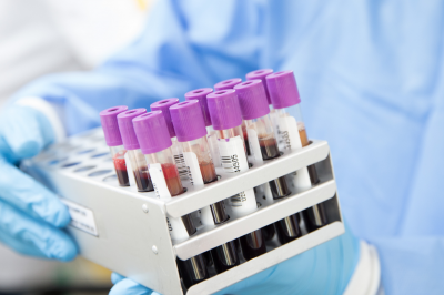 Is Blood Transfusion Haram?